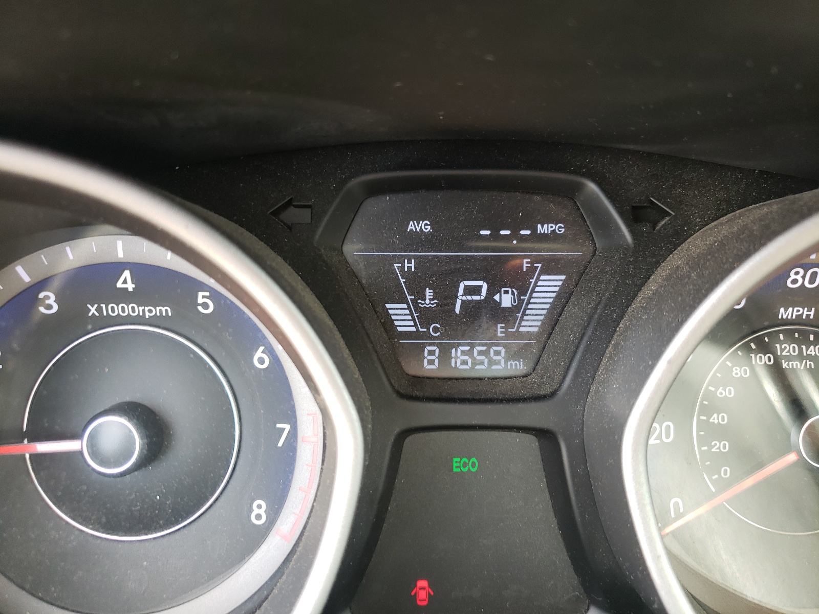 Photo 8 from auction – 2016 HYUNDAI ELANTRA SE with VIN KMHDH4AE3GU589832