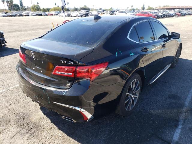 Photo 4 from auction – 2018 ACURA TLX TECH with VIN 19UUB2F52JA007460
