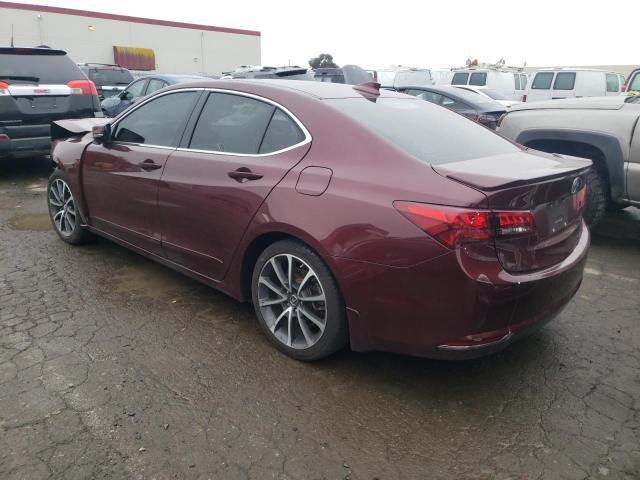 Photo 3 from auction – 2015 ACURA TLX ADVANC with VIN 19UUB2F70FA003464