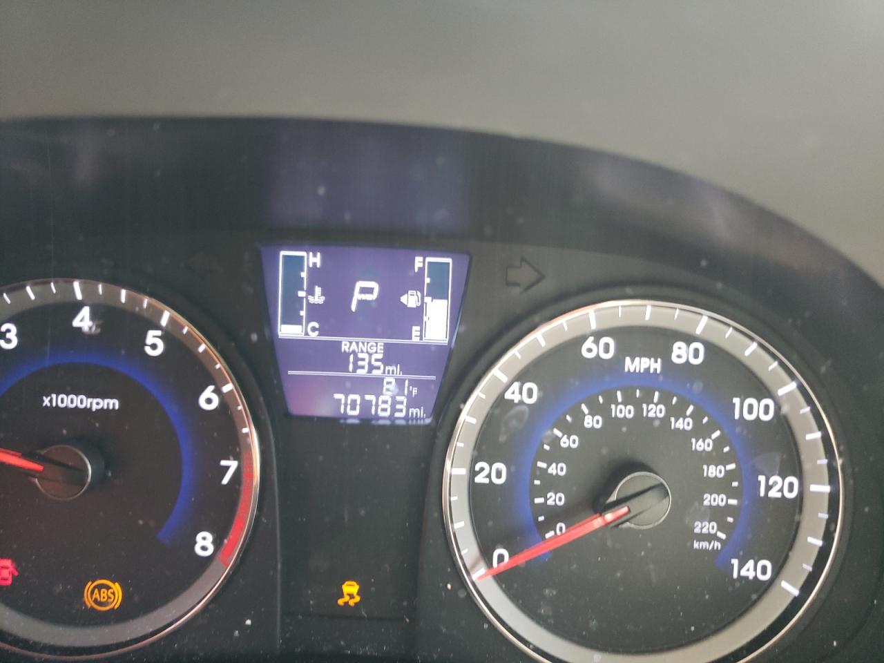Photo 8 from auction – 2017 HYUNDAI ACCENT SE with VIN KMHCT4AE7HU350277