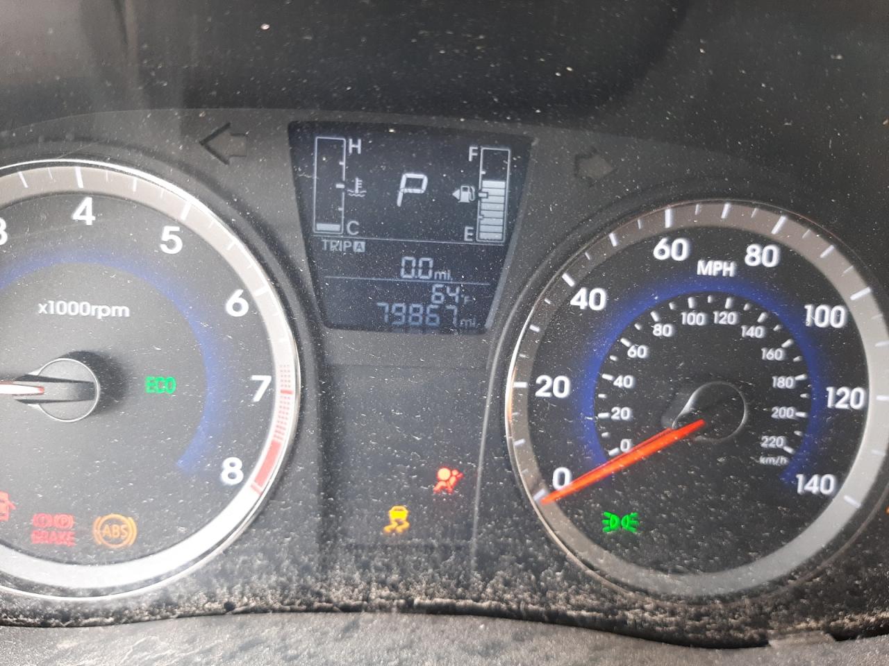 Photo 8 from auction – 2017 HYUNDAI ACCENT SE with VIN KMHCT4AEXHU302305