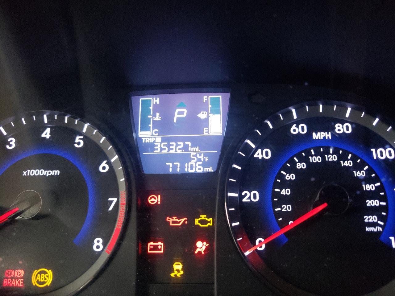 Photo 8 from auction – 2017 HYUNDAI ACCENT SE with VIN KMHCT5AEXHU312421