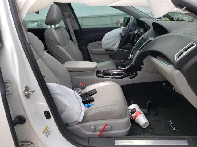Photo 5 from auction – 2017 ACURA TLX TECH with VIN 19UUB1F50HA002293