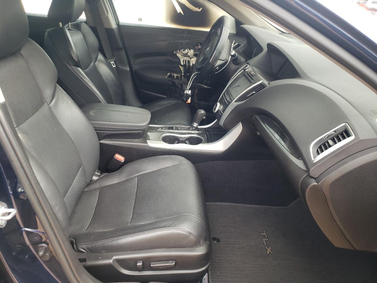 Photo 5 from auction – 2018 ACURA TLX TECH with VIN 19UUB1F55JA006345