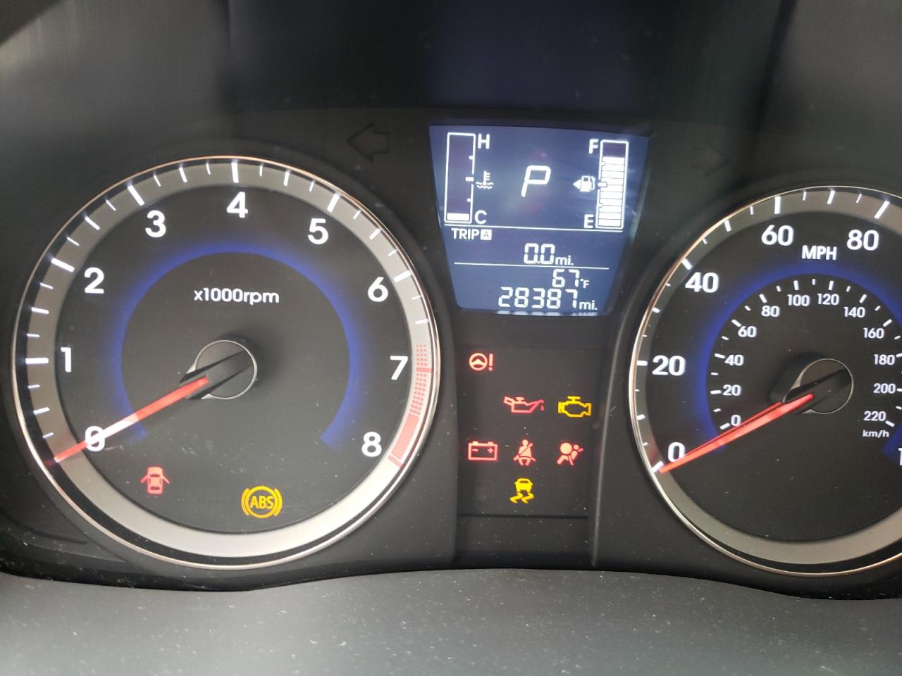 Photo 8 from auction – 2016 HYUNDAI ACCENT SE with VIN KMHCT4AE8GU140012