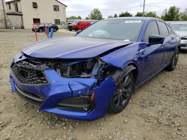 Photo 2 from auction – 2021 ACURA TLX TECH A with VIN 19UUB6F53MA003574