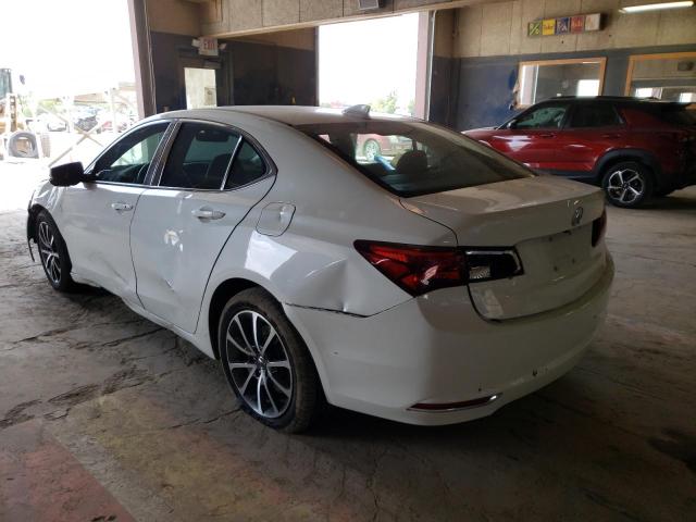 Photo 3 from auction – 2017 ACURA TLX TECH with VIN 19UUB2F59HA004811