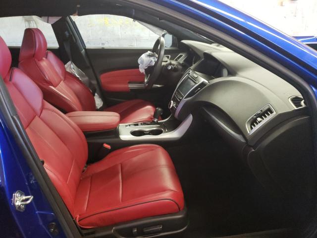 Photo 5 from auction – 2020 ACURA TLX TECHNO with VIN 19UUB1F60LA008970