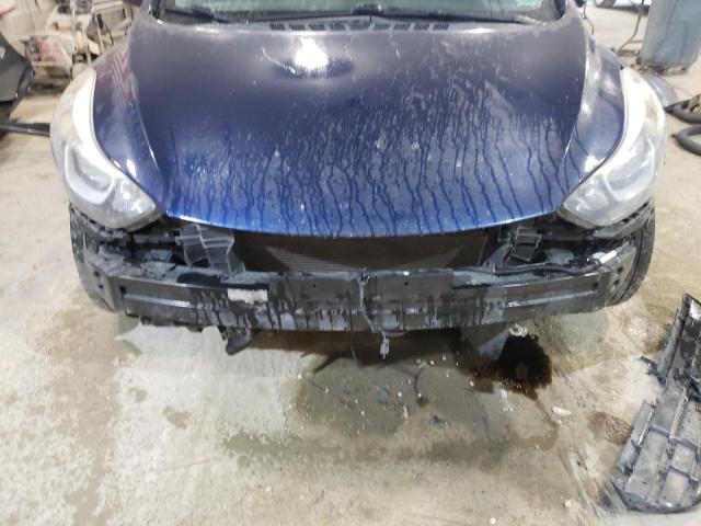 Photo 9 from auction – 2016 HYUNDAI ELANTRA SE with VIN 5NPDH4AE6GH717592