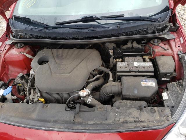 Photo 7 from auction – 2017 HYUNDAI ACCENT SE with VIN KMHCT4AE8HU378623