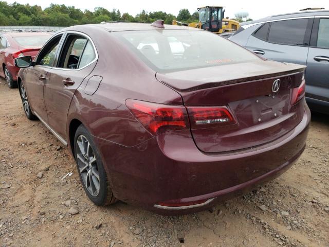 Photo 3 from auction – 2015 ACURA TLX TECH with VIN 19UUB2F50FA007612