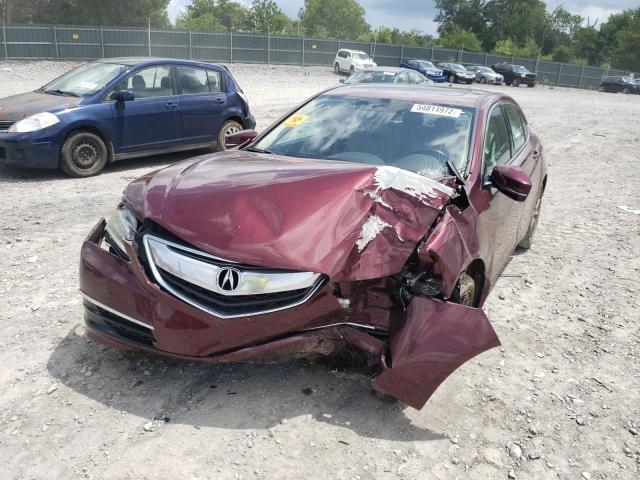 Photo 2 from auction – 2015 ACURA TLX TECH with VIN 19UUB2F5XFA019668