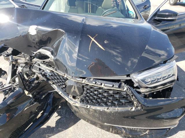 Photo 7 from auction – 2018 ACURA TLX with VIN 19UUB2F33JA006753