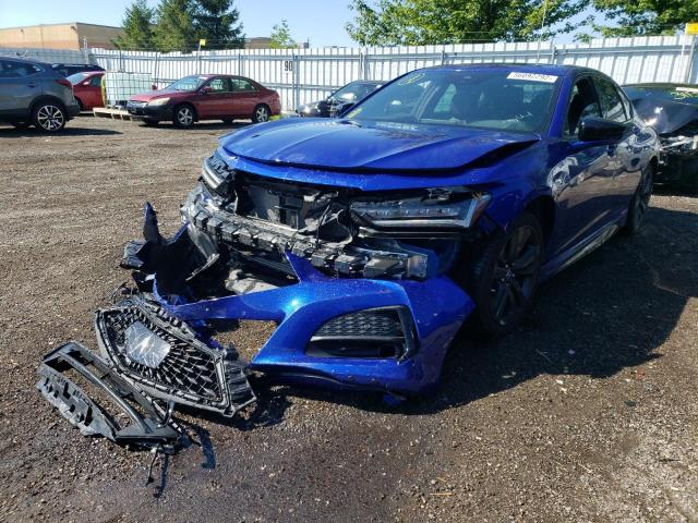 Photo 2 from auction – 2021 ACURA TLX TECH A with VIN 19UUB6F51MA800440