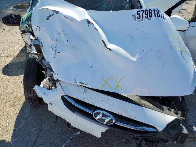 Photo 7 from auction – 2015 HYUNDAI ACCENT GLS with VIN KMHCT4AE9FU934872