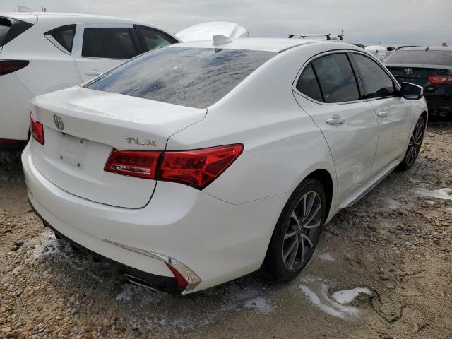 Photo 4 from auction – 2018 ACURA TLX TECH with VIN 19UUB2F55JA004407