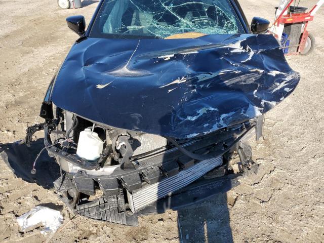 Photo 9 from auction – 2021 ACURA TLX TECH A with VIN 19UUB5F51MA008024