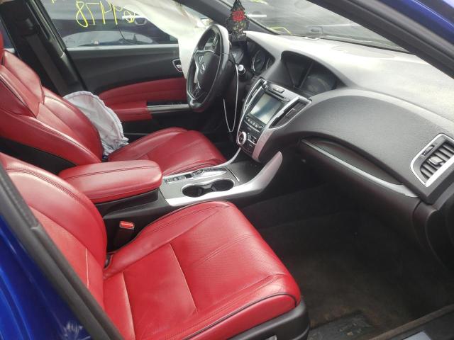 Photo 5 from auction – 2018 ACURA TLX TECH+A with VIN 19UUB3F61JA005939