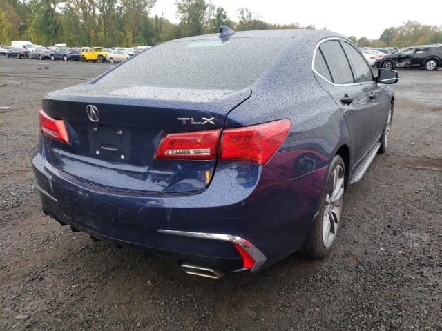 Photo 4 from auction – 2019 ACURA TLX TECHNO with VIN 19UUB2F47KA000741