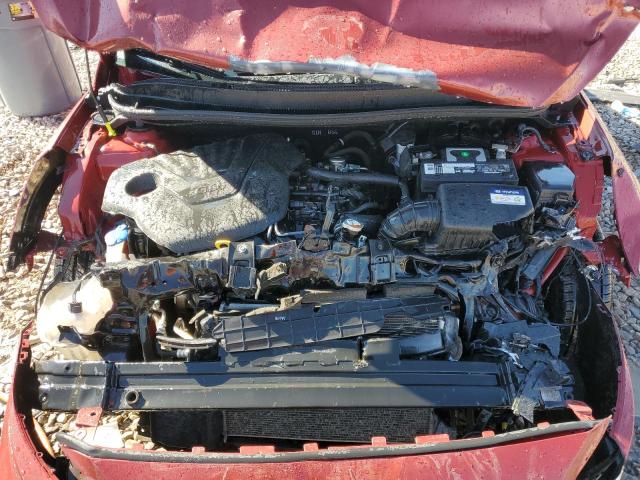 Photo 7 from auction – 2017 HYUNDAI ACCENT SE with VIN KMHCT4AE5HU376568