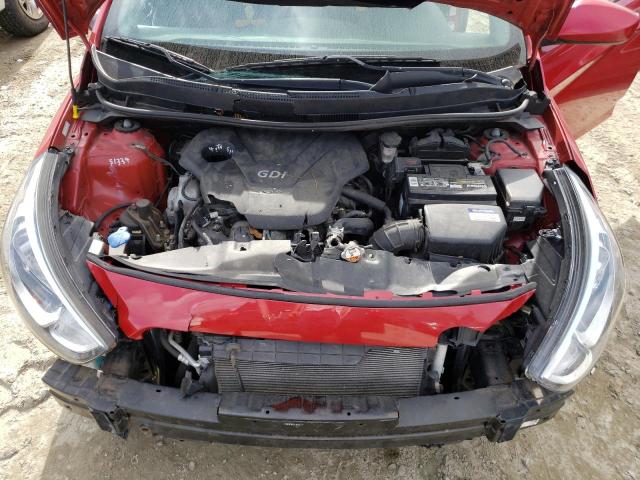 Photo 7 from auction – 2016 HYUNDAI ACCENT SE with VIN KMHCT4AE6GU987174