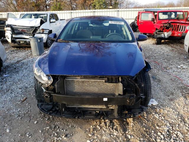 Photo 5 from auction – 2021 KIA FORTE FE with VIN 3KPF24AD4ME360947