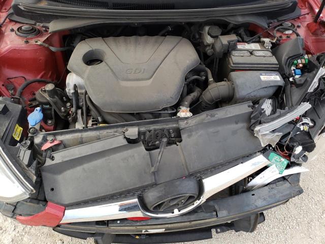 Photo 11 from auction – 2017 HYUNDAI VELOSTER with VIN KMHTC6AD8HU324127