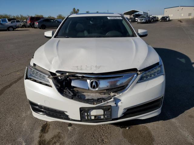 Photo 5 from auction – 2017 ACURA TLX TECH with VIN 19UUB1F50HA002861