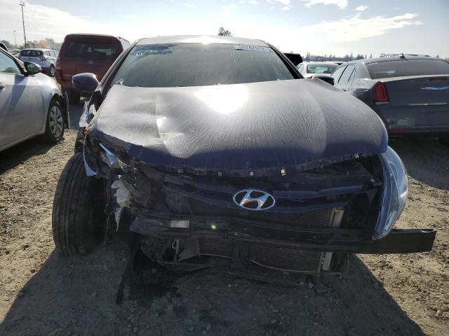 Photo 5 from auction – 2012 HYUNDAI SONATA GLS with VIN 5NPEB4AC0CH482640