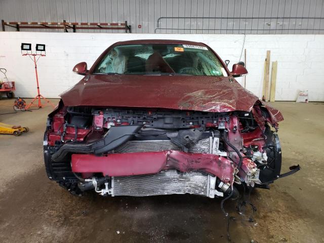 Photo 5 from auction – 2017 BUICK REGAL with VIN 2G4GM5EXXH9138597