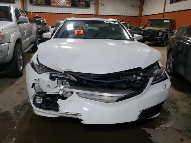 Photo 5 from auction – 2015 ACURA TLX ADVANC with VIN 19UUB3F70FA802702