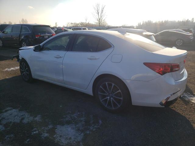 Photo 2 from auction – 2018 ACURA TLX with VIN 19UUB3F38JA801500
