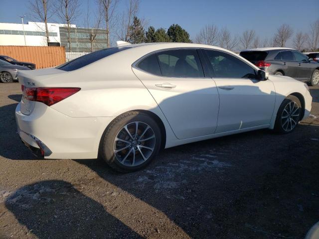 Photo 3 from auction – 2018 ACURA TLX with VIN 19UUB3F38JA801500