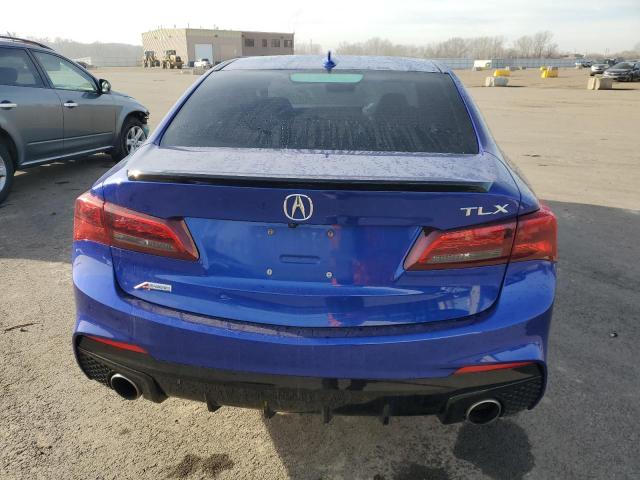 Photo 6 from auction – 2018 ACURA TLX TECH+A with VIN 19UUB2F63JA006097