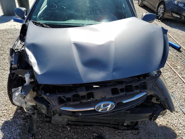 Photo 11 from auction – 2016 HYUNDAI ACCENT SE with VIN KMHCT4AE0GU985825