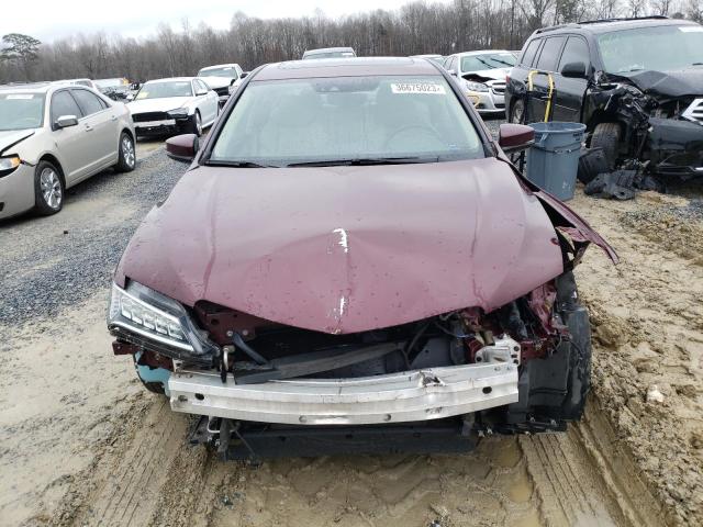 Photo 5 from auction – 2016 ACURA TLX TECH with VIN 19UUB2F56GA005512