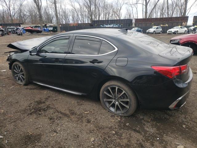 Photo 2 from auction – 2018 ACURA TLX TECH with VIN 19UUB2F5XJA005665