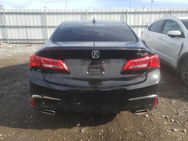 Photo 6 from auction – 2020 ACURA TLX TECHNO with VIN 19UUB2F45LA005101