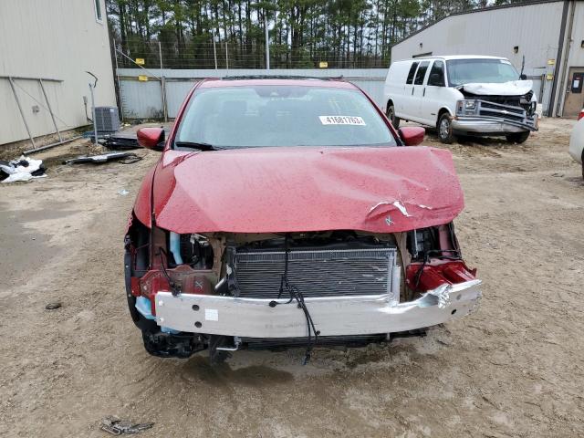 Photo 5 from auction – 2020 ACURA ILX PREMIU with VIN 19UDE2F71LA003010