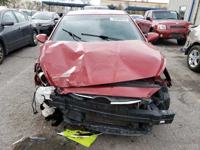 Photo 5 from auction – 2017 HYUNDAI ACCENT SE with VIN KMHCT4AE2HU378620