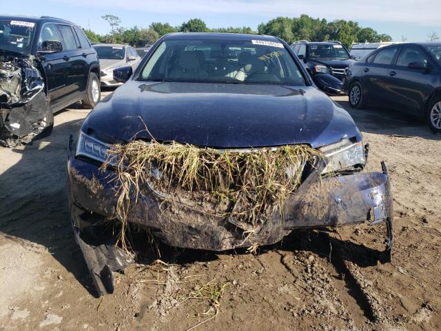 Photo 5 from auction – 2016 ACURA TLX with VIN 19UUB1F36GA003252
