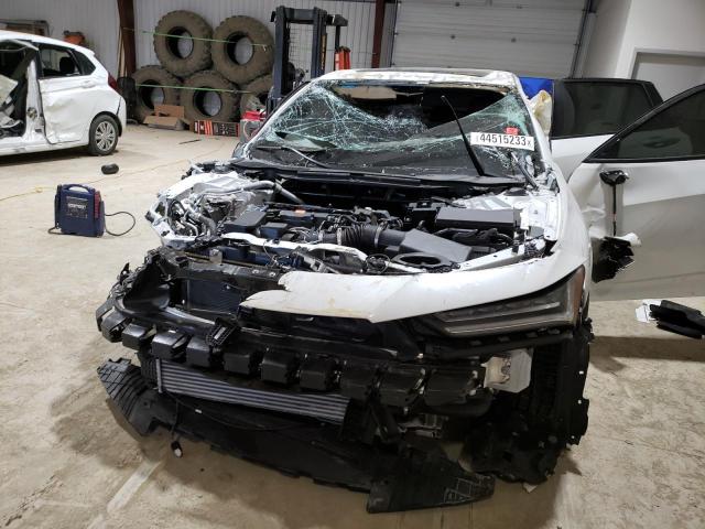Photo 5 from auction – 2022 ACURA TLX TECH A with VIN 19UUB6F50NA003176