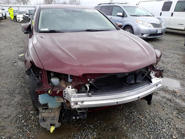 Photo 5 from auction – 2015 ACURA TLX TECH with VIN 19UUB1F56FA020598