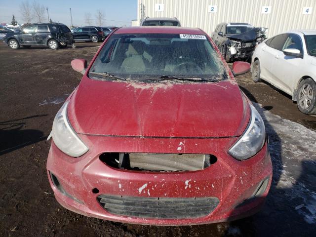 Photo 5 from auction – 2016 HYUNDAI ACCENT SE with VIN KMHCT4AE0GU954378