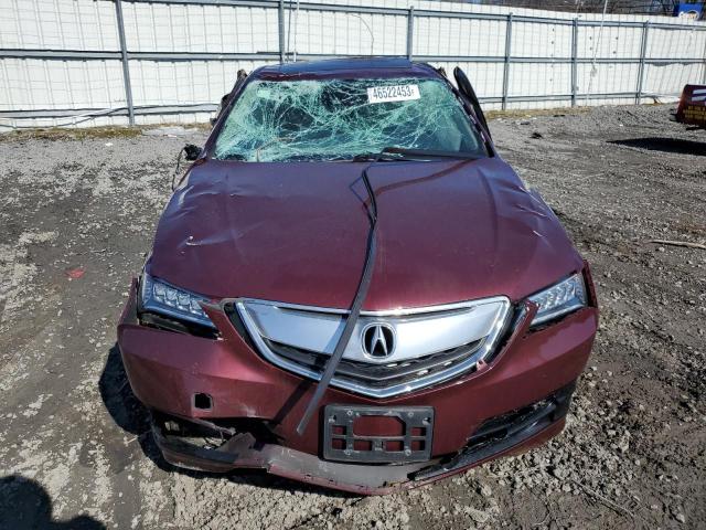 Photo 5 from auction – 2015 ACURA TLX TECH with VIN 19UUB1F55FA020575