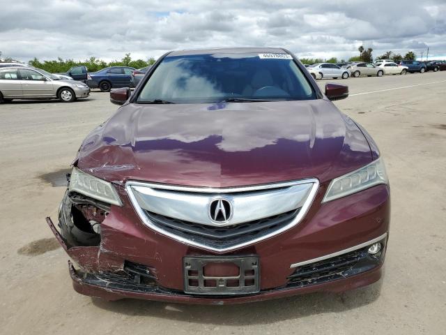 Photo 5 from auction – 2015 ACURA TLX ADVANC with VIN 19UUB2F79FA003477