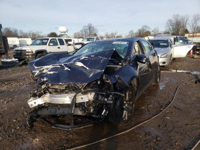 Photo 2 from auction – 2015 ACURA TLX with VIN 19UUB2F30FA019306