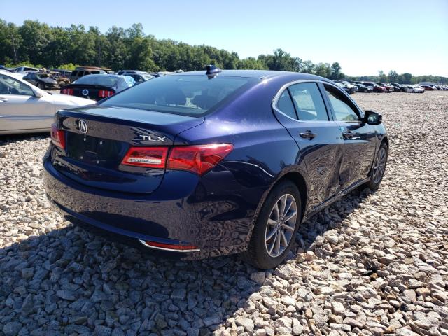 Photo 4 from auction – 2018 ACURA TLX with VIN 19UUB1F36JA008040