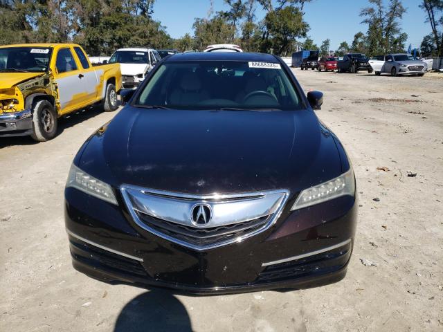 Photo 5 from auction – 2017 ACURA TLX with VIN 19UUB2F3XHA002290