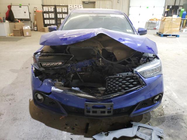 Photo 5 from auction – 2018 ACURA TLX TECH+A with VIN 19UUB3F64JA002792